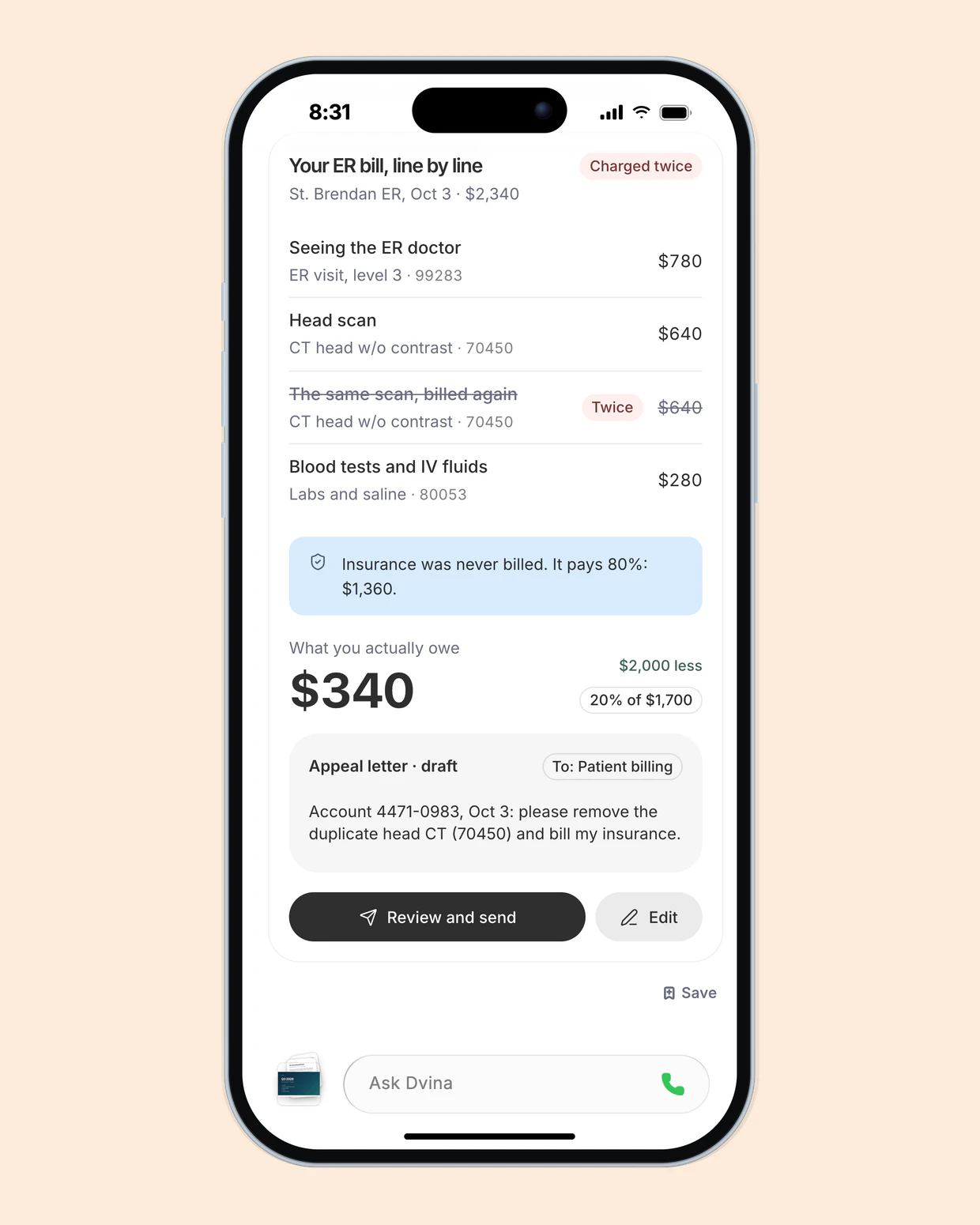 Dvina su un iPhone: la fattura del pronto soccorso, voce per voce. Visita del medico di pronto soccorso: 780 $. Esame alla testa: 640 $. Lo stesso esame addebitato di nuovo per 640 $, segnalato come duplicato. Esami del sangue e flebo: 280 $. Il conto non è mai stato presentato all'assicurazione; la polizza copre l'80 percento, pari a 1.360 $. Quanto devi pagare davvero: 340 $, cioè 2.000 $ in meno rispetto alla fattura. Una lettera di contestazione già scritta, con il comando «Rivedi e invia».